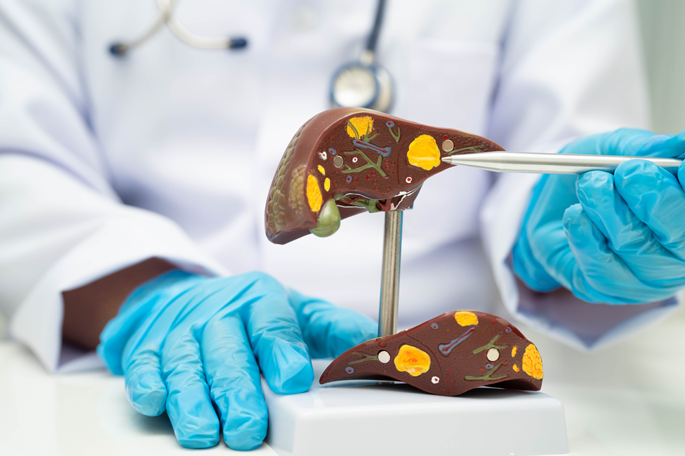 Could You Be at Risk for Liver Cancer What to Know